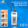 ประเทศจีน Newest and hot sale 1064&amp;532nm active EO Q switch ND YAG laser for tattoo removal โรงงาน